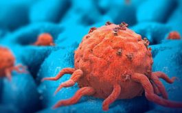 Bản ung thư có bản chất là sự tăng sinh quá mức của một số tế bào. Nó khác hoàn toàn với bản chất của bệnh trĩ