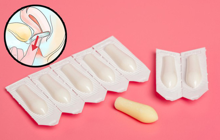 Trên thị trường có nhiều loại thuốc đặt âm đạo giúp điều trị viêm lộ tuyến cổ tử cung