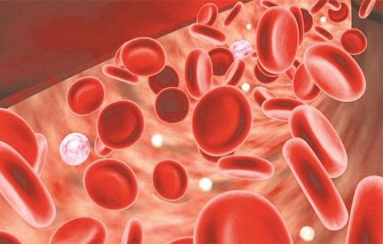 Rong kinh kéo dài sẽ gây ra tình trạng mất máu, thiếu máu
