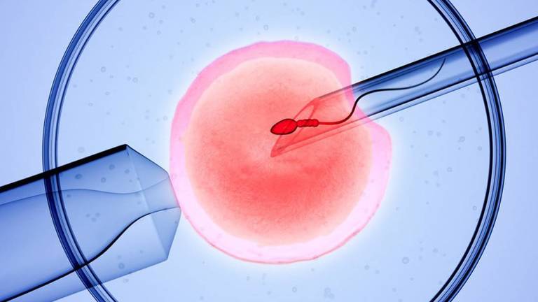 Trong quá trình cho tinh trùng kết hợp với trứng nếu thực hiện theo kỹ thuật ICSI thì tỷ lệ thành công sẽ cao hơn