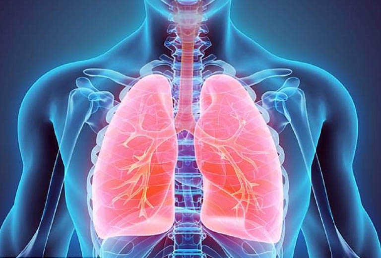 Viêm phế quản phổi