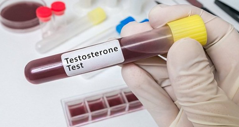 Kiểm tra nồng độ hormone testosterone trong máu 