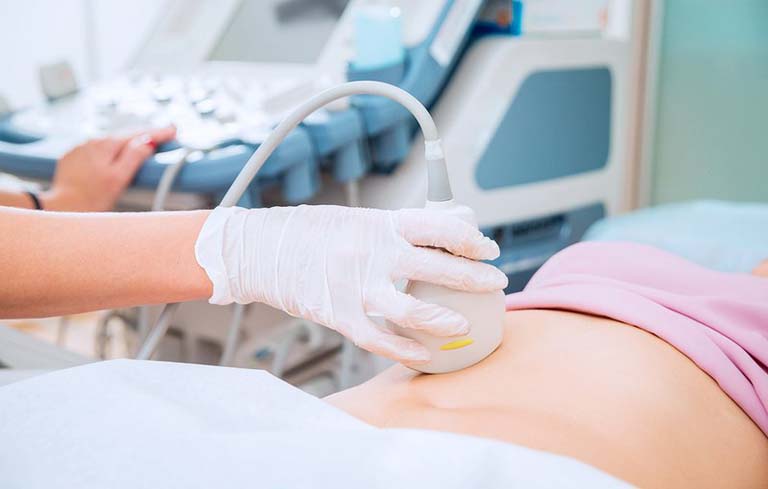 Siêu âm buồng trứng đa nang là phương pháp chẩn đoán bệnh phổ biến