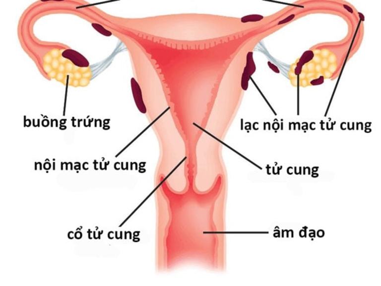 Trong cơ thể người phụ nữ, tinh trùng chỉ tồn tại trong khoảng 3 ngày.