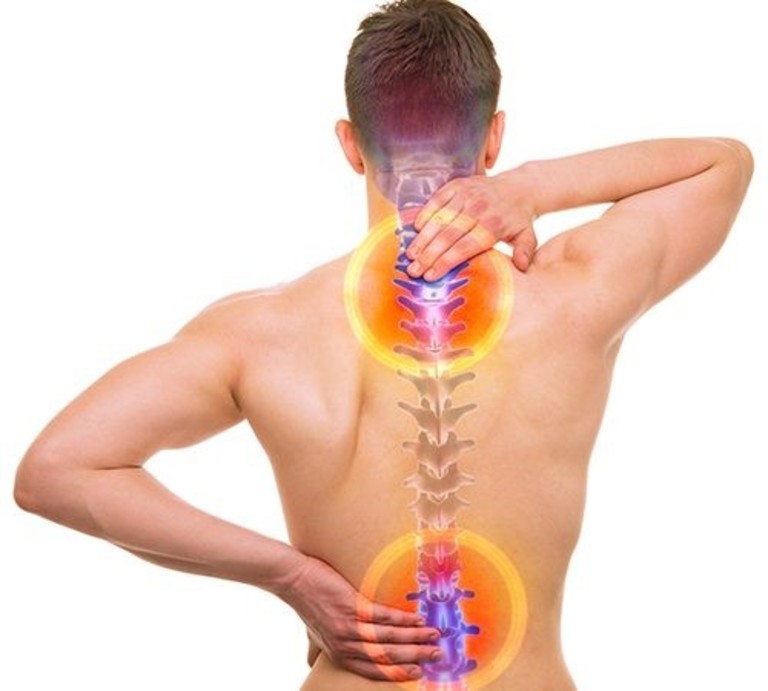 Đốt sống cổ và thắt lưng là hai vị trí dễ thoái hóa và xảy ra biến chứng nhiều nhất.