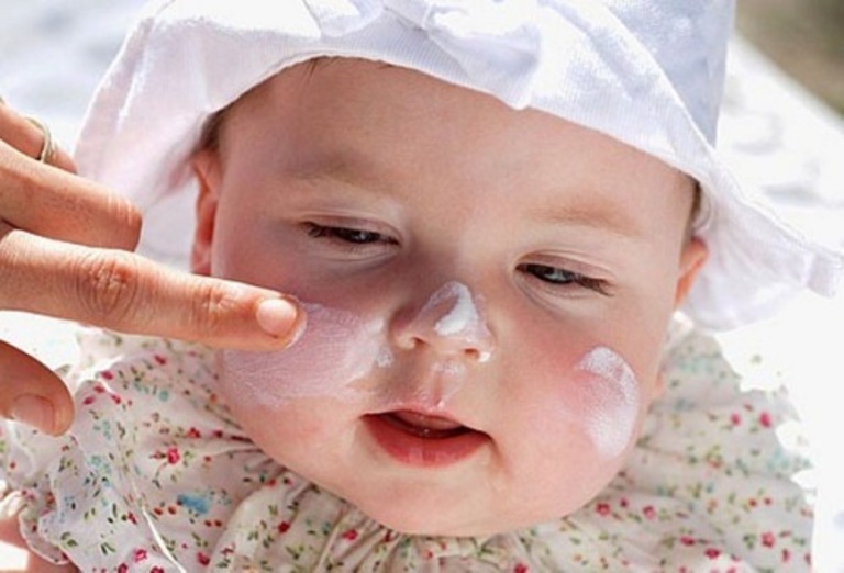 Da của bé bị chàm sữa cần được vệ sinh đúng cách. Các sản phẩm bôi ngoài da cần tham khảo ý kiến bác sĩ.