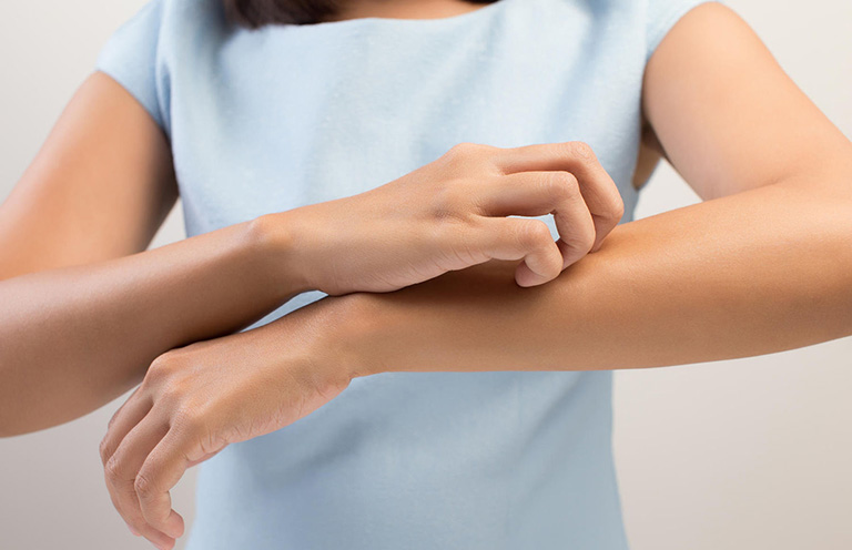Không dùng tay cào gãi lên vùng da bị tổn thương khiến bệnh chuyển biến nặng hơn