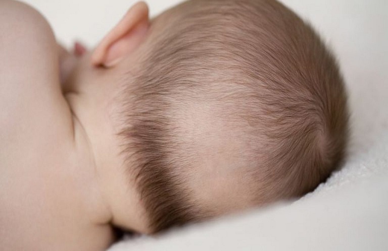 Sau khi sinh là giai đoạn rụng tóc ở trẻ