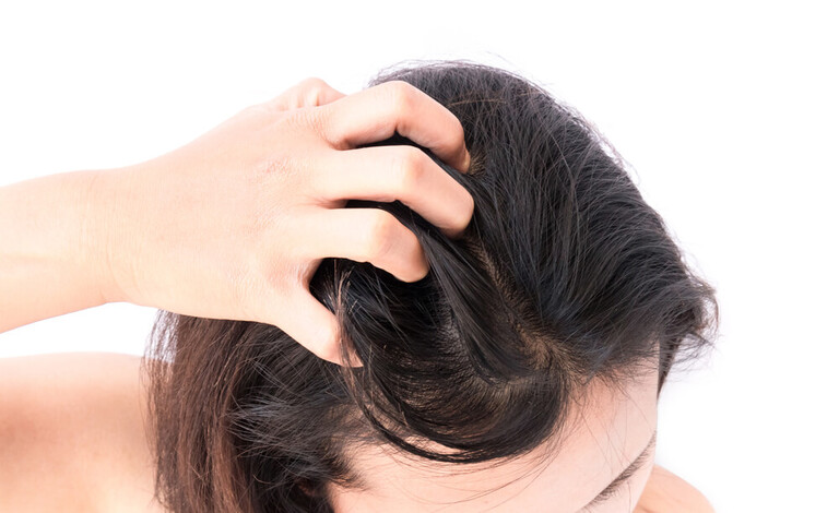 Nếu chỉ dựa vào dấu hiệu lâm sàng ban đầu, người ra rất dễ nhầm lẫn giữa nấm da đầu với gàu.