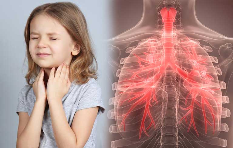 Viêm phế quản ở trẻ em gây ho, khó thở
