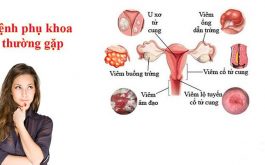 Viêm lộ tuyến cổ tử cung là nguyên nhân gây ra nhiều bệnh phụ khoa khác ở nữ giới
