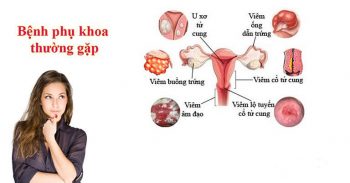 Viêm lộ tuyến cổ tử cung là nguyên nhân gây ra nhiều bệnh phụ khoa khác ở nữ giới