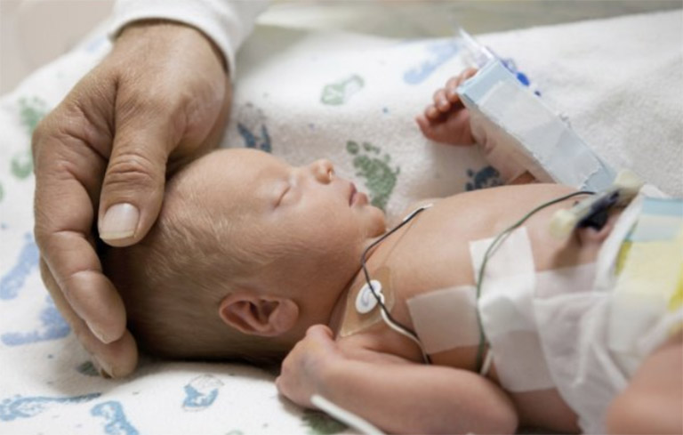 Trẻ sơ sinh có thể bị viêm phổi nếu không được điều trị viêm phế quản kịp thời