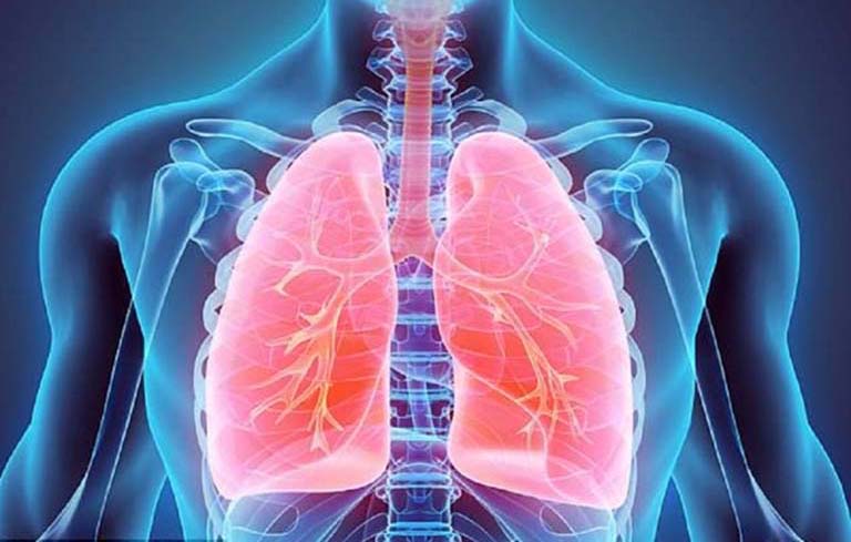 viêm phế quản phổi là gì