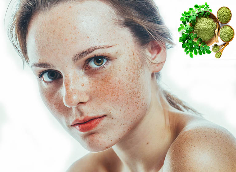 Cây chùm ngây là một trong những cây thuốc nam có tác dụng rất tốt trong việc điều trị nám trên da mặt