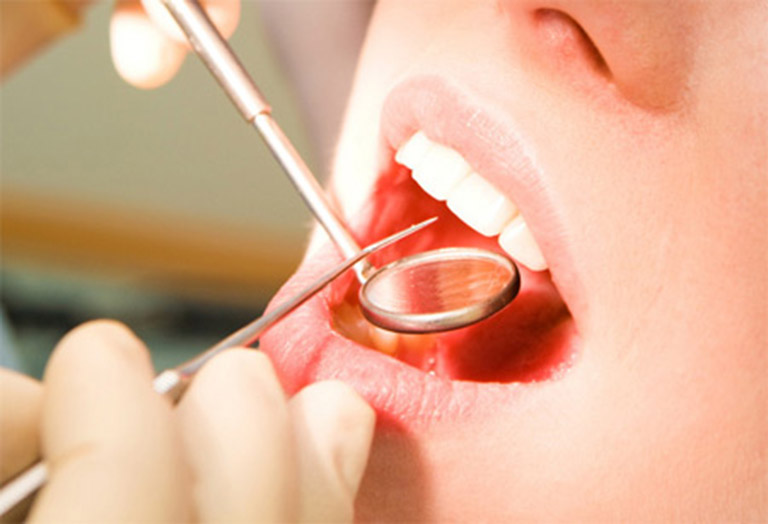Khám sức khỏe răng miệng định kỳ để phát hiện ra các bệnh lý nha khoa và điều trị từ sớm
