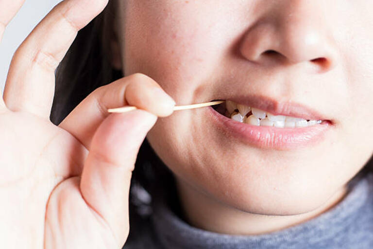 Lạm dụng tăm xỉa răng dễ dẫn đến teo nướu răng.