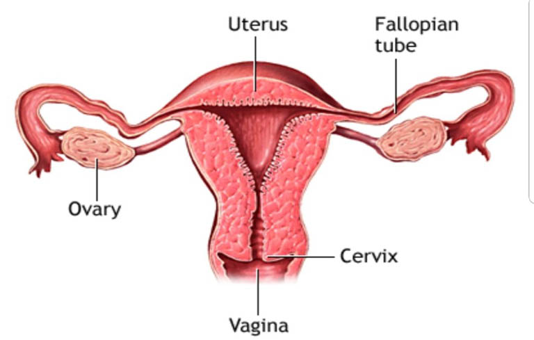 Tăng sản nội mạc tử cung cũng là nguyên nhân gây cường kinh