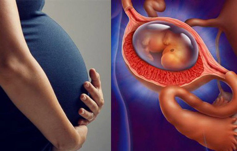 Mang thai ngoài tử cung là một trong những biến chứng của bệnh