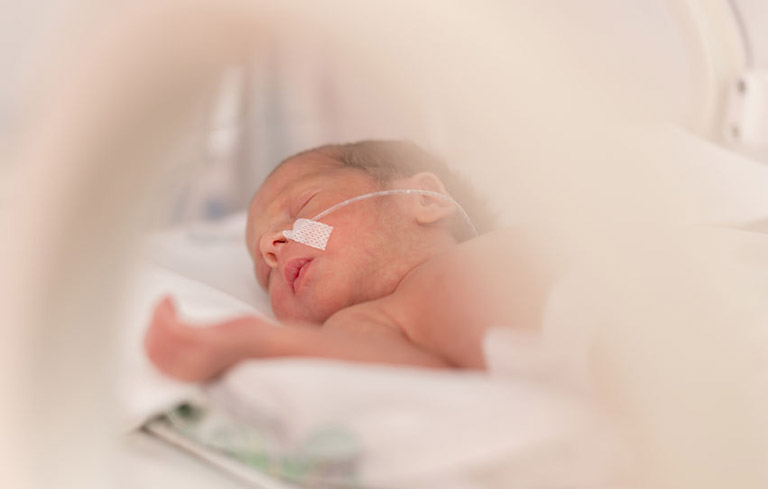 Viêm phổi hít ở trẻ sơ sinh