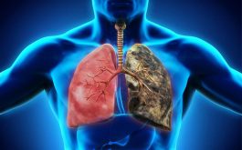 Viêm phổi có nguy hiểm không?