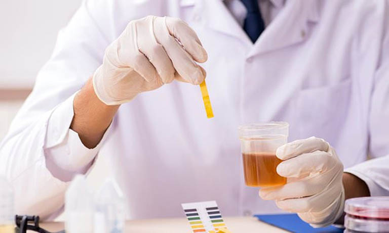 Xét nghiệm nước tiểu là phương pháp thường được áp dụng khi khám các bệnh nam khoa nói chung