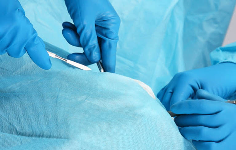 Phẫu thuật bóc tách là một trong những cách điều trị lạc nội mạc tử cung