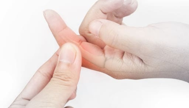 Nổi cục u ở khớp ngón tay là bệnh gì? Có phải Gout?