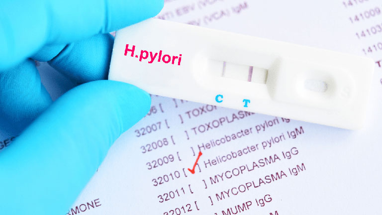 Kiểm tra nhiễm khuẩn HP để có biện pháp xử lý phù hợp