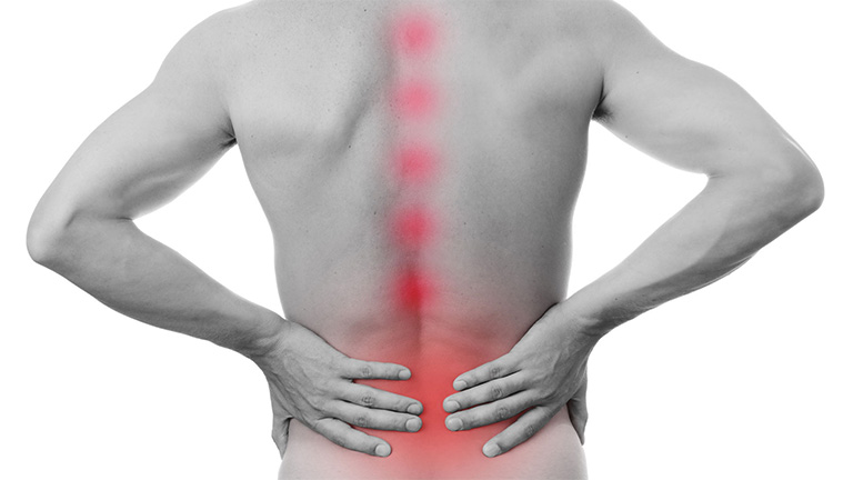 Đau ở thắt lưng, đau dọc cột sống là những triệu chứng thường gặp khi mắc bệnh gai cột sống
