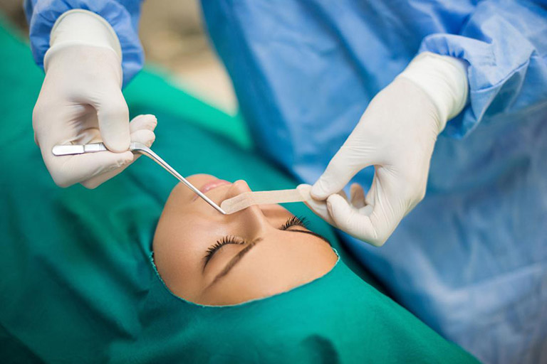 Phẫu thuật chỉnh hình vách ngăn mũi áp dụng cho các trường hợp lệch nhiều hoặc xuất hiện các biến chứng nguy hiểm gây khó thở
