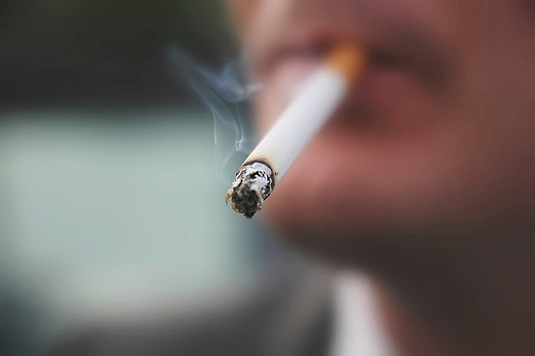 Tuyệt đối không hút thuốc lá hay tránh xa khói thuốc lá trong thời gian điều trị viêm xoang có polyp