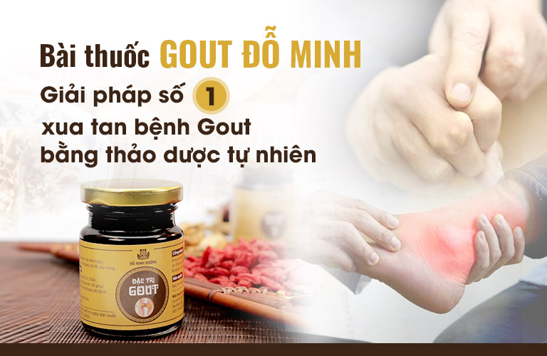 Gout Đỗ Minh - "Cứu tinh" cho hàng ngàn quý ông Việt khổ sở vì bệnh gout