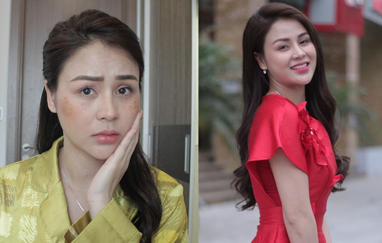 Làn da trước và sau khi dùng Vương Phi của diễn viên Lương Thu Trang